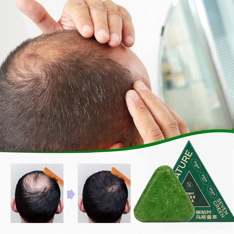 El Nature Triangle Shampoo Bar es un jabón–champú sólido de forma triangular que se volvió viral en redes sociales por su presentación llamativa y por la promesa de ayudar a fortalecer el cabello, reducir la caída y estimular su crecimiento. - Skinova