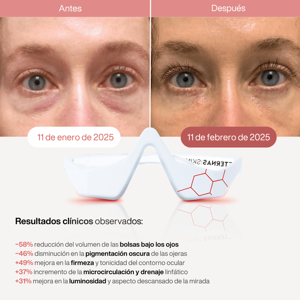 Reparador Bolsas y Ojeras con LED y Microcorriente - Skinova